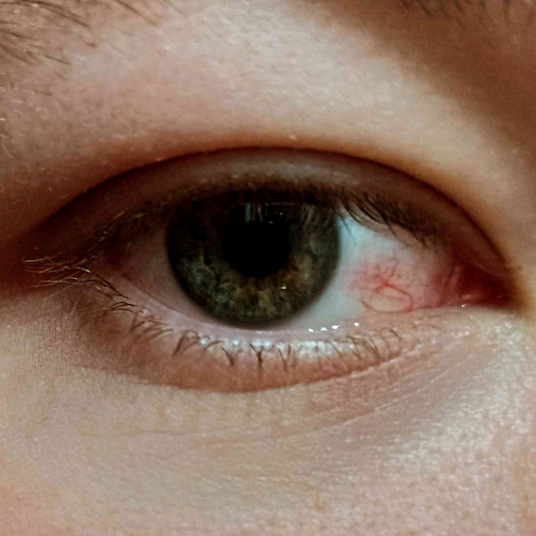 remomore (durov1.lens) Lens social identity (.lens handle) PFP