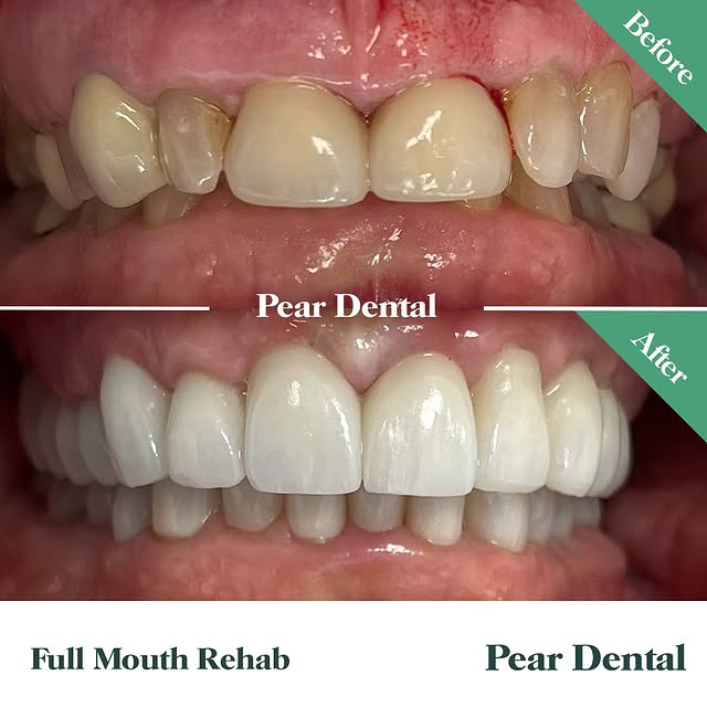 Eliot Renders (bttrack.lens) Lens social identity (.lens handle) PFP