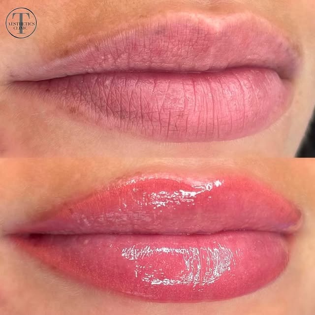 NanoWiz Labs (boomrat.lens) Lens social identity (.lens handle) PFP