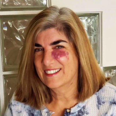 Shockinglydlish (shockinglydlish.lens) Lens social identity (.lens handle) PFP